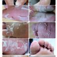 Beauty Foot Peeling