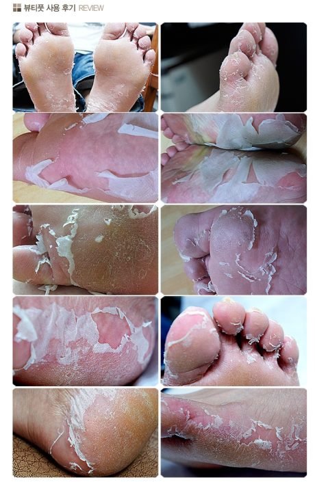 MED000801_Beauty Foot Peeling_0006