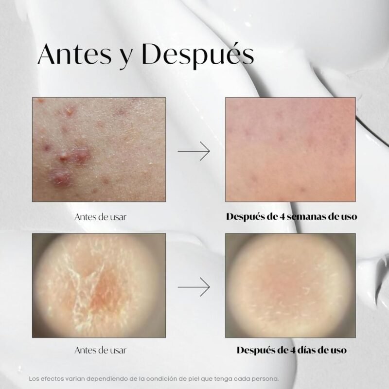 Cvt000201 vt 100 reedle shot pouch 10ea 0005